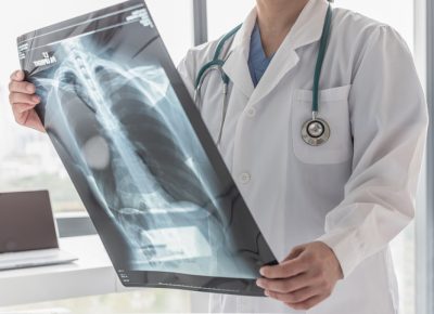 how much is an x ray at urgent care