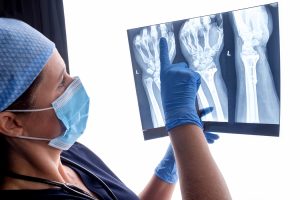 Where to Get Quick X-Rays in Philadelphia