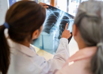 Where to Get Quick X-Rays in Philadelphia